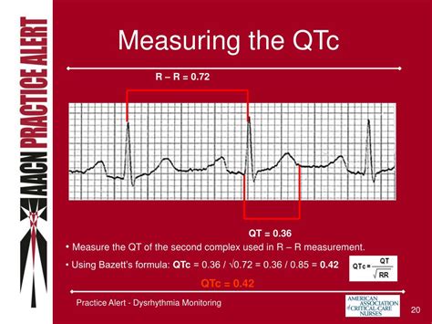 QTc Calculator